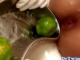 Twink asian patient shoots lemons anally